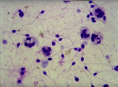 Alfazone élimine les processus inflammatoires